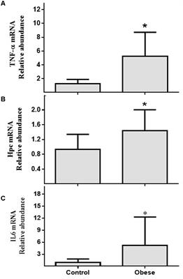 miR-155 and miR-122 Expression of Spermatozoa in Obese Subjects